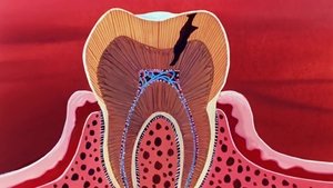 Рот и зубы